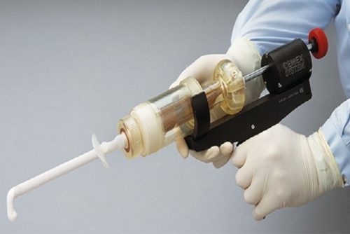 Person with gloves holding bone cement injection gun 